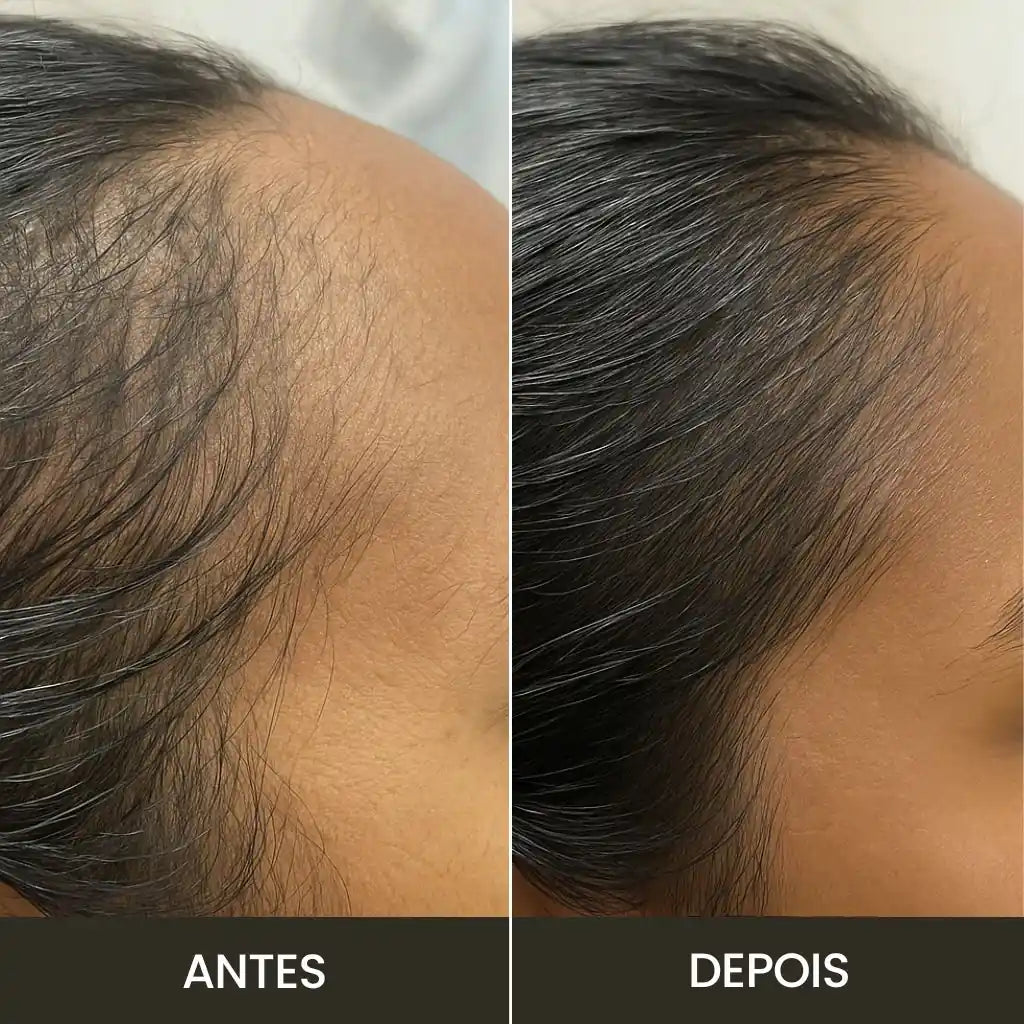 Escova de Terapia Capilar 4 em 1