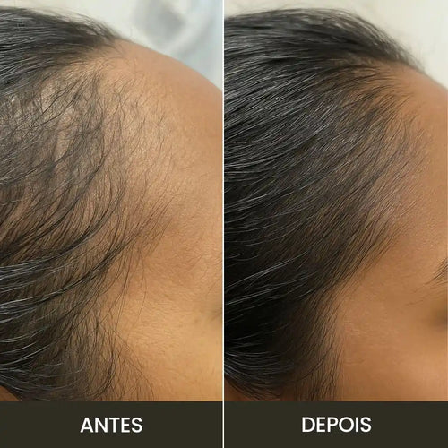 Escova de Terapia Capilar 4 em 1