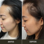 Escova de Terapia Capilar 4 em 1