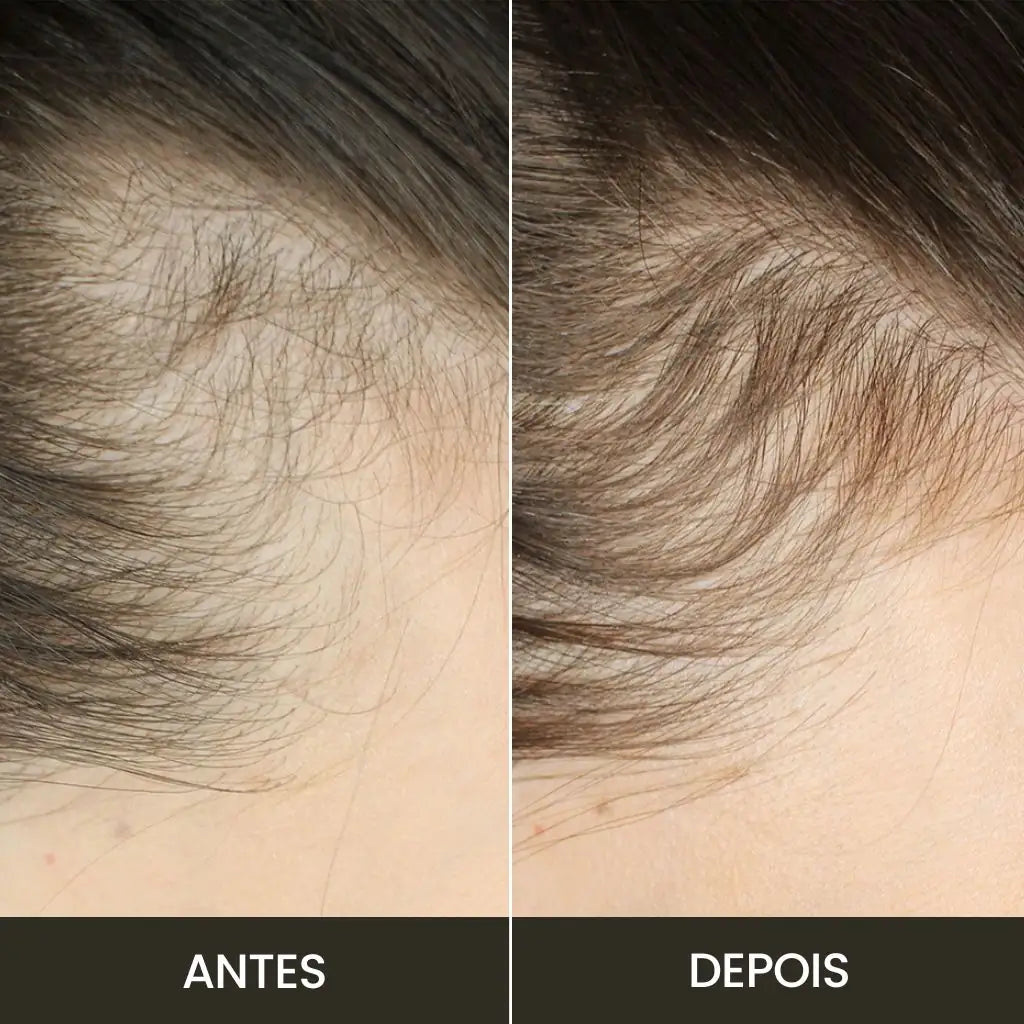 Escova de Terapia Capilar 4 em 1